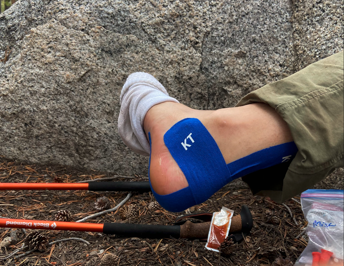 Taping up my right Achilles on Day 8 after I went a little too hard the day before (~19 mi). My ankle would not fully recover until after the trip.